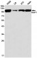 KAP1 (1A14) Rabbit Monoclonal Antibody